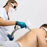 Eficacia de las depiladoras láser en hombres con vello facial grueso