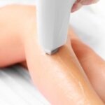 La importancia de las pruebas de sensibilidad en depilación láser